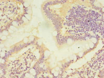 Immunohistochemistry of paraffin-embedded human small intestine tissue using CMBL Antibody at dilution of 1:100Rabbit anti-Human CMBL Polyclonal Antibody