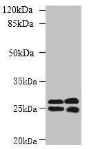Western blot  | All lanes: CMBL antibody at 1µg/ml  | Lane 1: Mouse kidney tissue  | Lane 2: Mouse liver tissue  | Secondary  | Goat polyclonal to rabbit IgG at 1/10000 dilution  | Predicted band size: 29 kDa  | Observed band size: 29, 25 kDaRabbit anti-Human CMBL Polyclonal Antibody