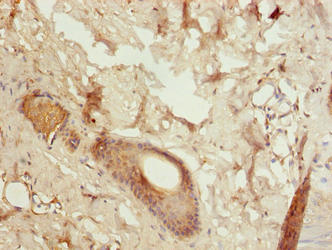 Immunohistochemistry of paraffin-embedded human skin tissue using LGALS12 Antibody at dilution of 1:100