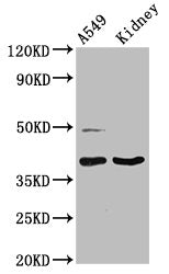 Western Blot  | Positive WB detected in: A549 whole cell lysate, Rat kidney tissue  | All lanes: LGALS12 antibody at 3µg/ml  | Secondary  | Goat polyclonal to rabbit IgG at 1/50000 dilution  | Predicted band size: 38, 32, 37, 30, 36 kDa  | Observed band size: 38 kDa