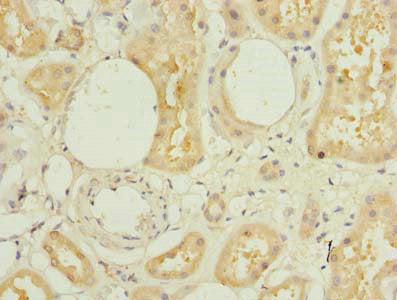 Immunohistochemistry of paraffin-embedded human kidney tissue using L3HYPDH Antibody at dilution of 1:100