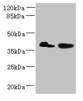 Western blot  | All lanes: L3HYPDH antibody at 8µg/ml  | Lane 1: HepG2 whole cell lysate  | Lane 2: A549 whole cell lysate  | Secondary  | Goat polyclonal to rabbit IgG at 1/10000 dilution  | Predicted band size: 39 kDa  | Observed band size: 39 kDa
