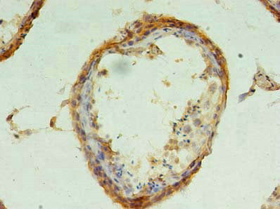 Immunohistochemistry of paraffin-embedded human testis tissue using the antibody at dilution of 1:100Rabbit anti-Human CHMP6 Polyclonal Antibody