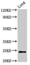 Western Blot  | Positive WB detected in: Rat lung tissue  | All lanes: CHMP6 antibody at 3µg/ml  | Secondary  | Goat polyclonal to rabbit IgG at 1/50000 dilution  | Predicted band size: 24 kDa  | Observed band size: 24 kDaRabbit anti-Human CHMP6 Polyclonal Antibody