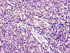 Immunohistochemistry of paraffin-embedded human lymph node tissue using SMARCD1 Antibody at dilution of 1:100Rabbit anti-Human SMARCD1 Polyclonal Antibody