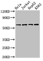 Western Blot  | Positive WB detected in: Hela whole cell lysate, Jurkat whole cell lysate, HepG2 whole cell lysate, K562 whole cell lysate  | All lanes: SMARCD1 antibody at 3.2µg/ml  | Secondary  | Goat polyclonal to rabbit IgG at 1/50000 dilution  | Predicted band size: 59, 54 kDa  | Observed band size: 59 kDaRabbit anti-Human SMARCD1 Polyclonal Antibody