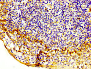 IHC image of MASTL Antibody diluted at 1:200 and staining in paraffin-embedded human tonsil tissue performed on a Leica BondTM system. After dewaxing and hydration, antigen retrieval was mediated by high pressure in a citrate buffer (pH 6.0). Section was blocked with 10% normal goat serum 30min at RT. Then primary antibody (1% BSA) was incubated at 4°C overnight. The primary is detected by a biotinylated secondary antibody and visualized using an HRP conjugated SP system.