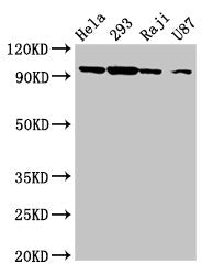 Western Blot  | Positive WB detected in: Hela whole cell lysate, 293 whole cell lysate, Raji whole cell lysate, U87 whole cell lysate  | All lanes: MASTL antibody at 6.3µg/ml  | Secondary  | Goat polyclonal to rabbit IgG at 1/50000 dilution  | Predicted band size: 98, 93 kDa  | Observed band size: 98 kDa