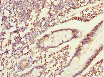 Immunohistochemistry of paraffin-embedded human small intestine tissue using ERO1A Antibody at dilution of 1:100Rabbit anti-Human ERO1A Polyclonal Antibody