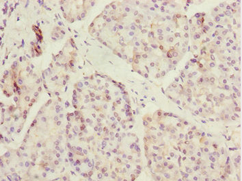 Immunohistochemistry of paraffin-embedded human pancreatic tissue using ERO1A Antibody at dilution of 1:100Rabbit anti-Human ERO1A Polyclonal Antibody