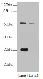 Western blot | All lanes: ERO1L antibody at 1.25μg/ml | Lane 1: A431 whole cell lysate | Lane 2: 293T whole cell lysate | Secondary | Goat polyclonal to rabbit IgG at 1/10000 dilution | Predicted band size: 54 kDa | Observed band size: 54, 25 kDaRabbit anti-Human ERO1A Polyclonal Antibody