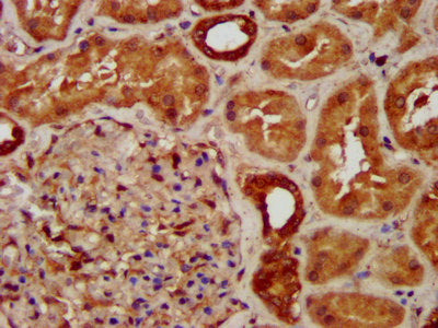 IHC image of SUCLG2 Antibody diluted at 1:300 and staining in paraffin-embedded human kidney tissue performed on a Leica BondTM system. After dewaxing and hydration, antigen retrieval was mediated by high pressure in a citrate buffer (pH 6.0). Section was blocked with 10% normal goat serum 30min at RT. Then primary antibody (1% BSA) was incubated at 4°C overnight. The primary is detected by a biotinylated secondary antibody and visualized using an HRP conjugated SP system.Rabbit anti-Human SUCLG2 Polyclonal Antibody