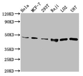 Western Blot  | Positive WB detected in: Hela whole cell lysate, MCF-7 whole cell lysate, 293T whole cell lysate, Raji whole cell lysate, LO2 whole cell lysate, U87 whole cell lysate,   | All lanes: SUCLG2 antibody at 6.7µg/ml  | Secondary  | Goat polyclonal to rabbit IgG at 1/50000 dilution  | Predicted band size: 47, 48 kDa  | Observed band size: 47 kDaRabbit anti-Human SUCLG2 Polyclonal Antibody