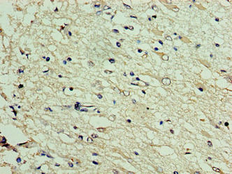 Immunohistochemistry of paraffin-embedded human brain tissue using the antibody at dilution of 1:100Rabbit anti-Human DNAJC30 Polyclonal Antibody