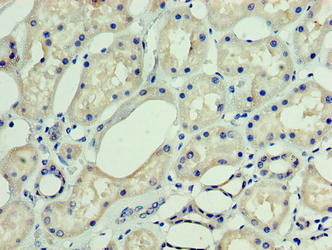Immunohistochemistry of paraffin-embedded human kidney tissue using DNAJC30 Antibody at dilution of 1:100Rabbit anti-Human DNAJC30 Polyclonal Antibody