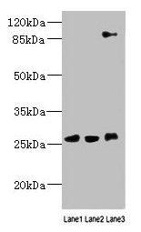 Western blot  | All lanes: DNAJC30 antibody at 10µg/ml  | Lane 1: 293T whole cell lysate  | Lane 2: U87 whole cell lysate  | Lane 3: SH-SY5Y whole cell lysate  | Secondary  | Goat polyclonal to rabbit IgG at 1/10000 dilution  | Predicted band size: 26 kDa  | Observed band size: 26, 90 kDaRabbit anti-Human DNAJC30 Polyclonal Antibody