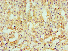 Immunohistochemistry of paraffin-embedded human adrenal gland tissue using CAMK1G Antibody at dilution of 1:100Rabbit anti-Human CAMK1G Polyclonal Antibody