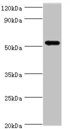 Western blot  | All lanes: CAMK1G antibody at 5µg/ml + HL60 whole cell lysate  | Secondary  | Goat polyclonal to rabbit IgG at 1/10000 dilution  | Predicted band size: 54, 52 kDa  | Observed band size: 54 kDa