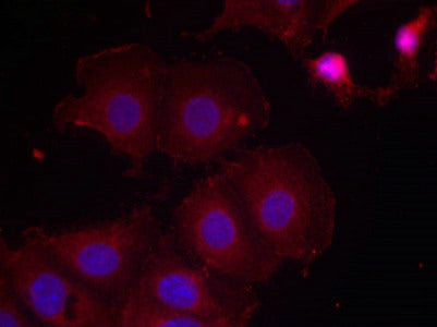 Immunofluorescence staining of methanol-fixed MCF7 cells using HER2(Phospho-Tyr877) Antibody.Rabbit anti-Human ERBB2 Polyclonal Antibody