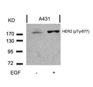 Western blot analysis of extracts from A431 cells untreated or treated with EGF using HER2(Phospho-Tyr877) Antibody.Rabbit anti-Human ERBB2 Polyclonal Antibody