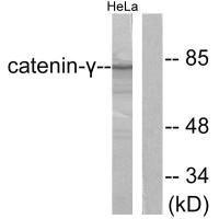 Western blot analysis of extracts from HeLa cells, using Catenin-γ antibody.