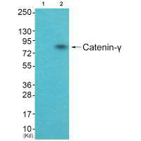 Western blot analysis of extracts from HuvEc cells (Lane 2), using Catenin-γ antiobdy. The lane on the left is treated with systhesized peptide.