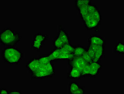 Immunofluorescent analysis of PC-3 cells using ALKBH3 Antibody at dilution of 1:100 and Alexa Fluor 488-congugated AffiniPure Goat Anti-Rabbit IgG(H+L)Rabbit anti-Human ALKBH3 Polyclonal Antibody