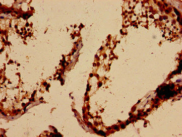 Immunohistochemistry analysis of human testis tissue using the antibody at dilution of 1:100Rabbit anti-Human ALKBH3 Polyclonal Antibody