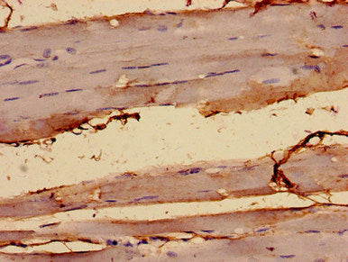 Immunocytochemistry analysis of human skeletal muscle tissue using ALKBH3 Antibody at dilution of 1:100Rabbit anti-Human ALKBH3 Polyclonal Antibody