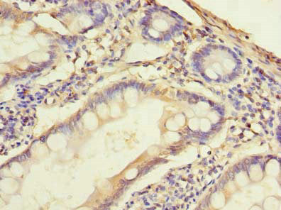 Immunohistochemistry of paraffin-embedded human small intestine tissue using SLC38A2 Antibody at dilution of 1:100Rabbit anti-Human SLC38A2 Polyclonal Antibody