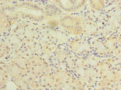 Immunohistochemistry of paraffin-embedded human pancreatic tissue using SLC38A2 Antibody at dilution of 1:100Rabbit anti-Human SLC38A2 Polyclonal Antibody