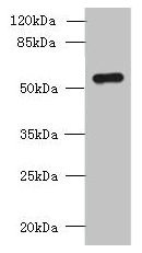 Western blot  | All lanes: SLC38A2 antibody at 1.5µg/ml + A431 whole cell lysate  | Secondary  | Goat polyclonal to rabbit IgG at 1/10000 dilution  | Predicted band size: 57, 46 kDa  | Observed band size: 57 kDaRabbit anti-Human SLC38A2 Polyclonal Antibody