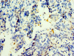 Immunohistochemistry of paraffin-embedded human lung tissue using TGS1 Antibody at dilution of 1:100Rabbit anti-Human TGS1 Polyclonal Antibody