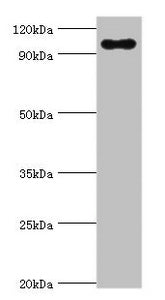 Western blot | All lanes: TGS1 antibody at 10μg/ml + Mouse skeletal muscle tissue | Secondary | Goat polyclonal to rabbit IgG at 1/10000 dilution | Predicted band size: 97 kDa | Observed band size: 97 kDaRabbit anti-Human TGS1 Polyclonal Antibody