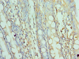 Immunohistochemistry of paraffin-embedded human colon tissue using SRPK1 Antibody at dilution of 1:100Rabbit anti-Human SRPK1 Polyclonal Antibody