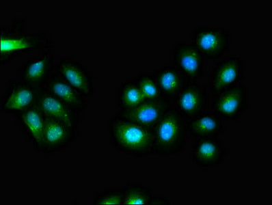 Immunofluorescent analysis of A549 cells using CDK5RAP2 Antibody at dilution of 1:100 and Alexa Fluor 488-congugated AffiniPure Goat Anti-Rabbit IgG(H+L)Rabbit anti-Human CDK5RAP2 Polyclonal Antibody