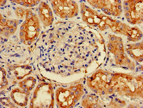 Immunohistochemistry of paraffin-embedded human kidney tissue using the antibody at dilution of 1:100Rabbit anti-Human CDK5RAP2 Polyclonal Antibody
