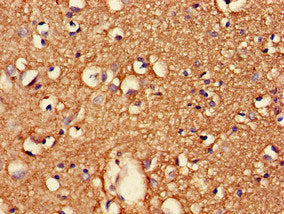 Immunohistochemistry of paraffin-embedded human brain tissue using CDK5RAP2 Antibody at dilution of 1:100Rabbit anti-Human CDK5RAP2 Polyclonal Antibody