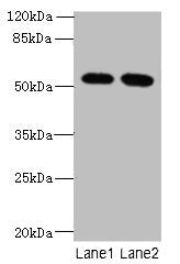 Western blot  | All lanes: INTS14 antibody at 4µg/ml  | Lane 1: Hela whole cell lysate  | Lane 2: NIH/3T3 whole cell lysate  | Secondary  | Goat polyclonal to rabbit IgG at 1/10000 dilution  | Predicted band size: 58, 10, 49, 51 kDa  | Observed band size: 58 kDa