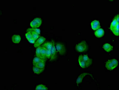 Immunofluorescence staining of MCF-7 cells with FUK Antibody at 1:100, counter-stained with DAPI. The cells were fixed in 4% formaldehyde, permeabilized using 0.2% Triton X-100 and blocked in 10% normal Goat Serum. The cells were then incubated with the antibody overnight at 4°C. The secondary antibody was Alexa Fluor 488-congugated AffiniPure Goat Anti-Rabbit IgG(H+L).Rabbit anti-Human FUK Polyclonal Antibody