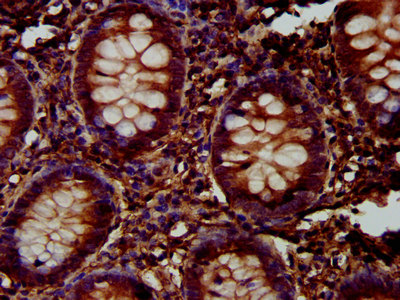 IHC image of FUK Antibody diluted at 1:300 and staining in paraffin-embedded human appendix tissue performed on a Leica BondTM system. After dewaxing and hydration, antigen retrieval was mediated by high pressure in a citrate buffer (pH 6.0). Section was blocked with 10% normal goat serum 30min at RT. Then primary antibody (1% BSA) was incubated at 4°C overnight. The primary is detected by a biotinylated secondary antibody and visualized using an HRP conjugated SP system.Rabbit anti-Human FUK Polyclonal Antibody