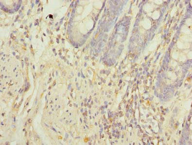Immunohistochemistry of paraffin-embedded human colon tissue using NXPE1 Antibody at dilution of 1:100Rabbit anti-Human NXPE1 Polyclonal Antibody