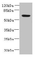 Western blot  | All lanes: NXPE1 antibody at 4µg/ml + Human high value serum  | Secondary  | Goat polyclonal to rabbit IgG at 1/10000 dilution  | Predicted band size: 64, 47 kDa  | Observed band size: 64 kDaRabbit anti-Human NXPE1 Polyclonal Antibody