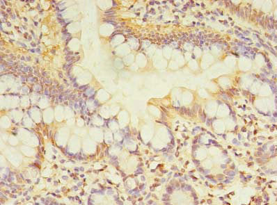 Immunohistochemistry of paraffin-embedded human small intestine tissue using TCP11L2 Antibody at dilution of 1:100Rabbit anti-Human TCP11L2 Polyclonal Antibody