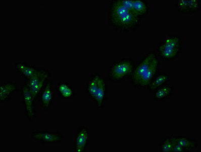 Immunofluorescent analysis of HepG2 cells using CERS5 Antibody at dilution of 1:100 and Alexa Fluor 488-congugated AffiniPure Goat Anti-Rabbit IgG(H+L)Rabbit anti-Human CERS5 Polyclonal Antibody