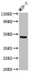 Western Blot  | Positive WB detected in: MCF-7 whole cell lysate  | All lanes: CERS5 antibody at 3µg/ml  | Secondary  | Goat polyclonal to rabbit IgG at 1/50000 dilution  | Predicted band size: 46, 40 kDa  | Observed band size: 46 kDaRabbit anti-Human CERS5 Polyclonal Antibody