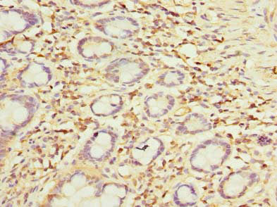 Immunohistochemistry of paraffin-embedded human small intestine tissue using OTUD6B Antibody at dilution of 1:100Rabbit anti-Human OTUD6B Polyclonal Antibody