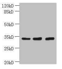 Western blot  | All lanes: OTUD6B antibody at 4µg/ml  | Lane 1: PC-3 whole cell lysate  | Lane 2: 293T whole cell lysate  | Lane 3: MDA-MB-231 whole cell lysate  | Secondary  | Goat polyclonal to rabbit IgG at 1/10000 dilution  | Predicted band size: 34, 22 kDa  | Observed band size: 34 kDaRabbit anti-Human OTUD6B Polyclonal Antibody
