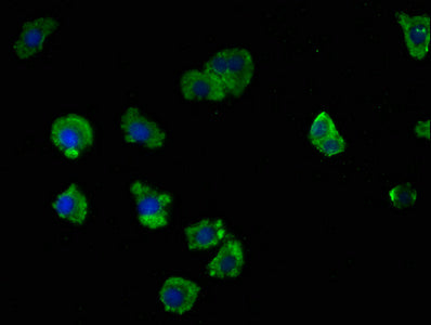 Immunofluorescence staining of HepG2 cells with LRTM2 Antibody at 1:100, counter-stained with DAPI. The cells were fixed in 4% formaldehyde, permeabilized using 0.2% Triton X-100 and blocked in 10% normal Goat Serum. The cells were then incubated with the antibody overnight at 4°C. The secondary antibody was Alexa Fluor 488-congugated AffiniPure Goat Anti-Rabbit IgG(H+L).