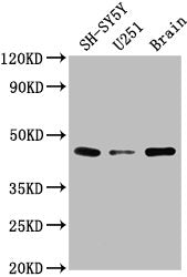 Western Blot  | Positive WB detected in: SH-SY5Y whole cell lysate, U251 whole cell lysate, Rat brain tissue  | All lanes: LRTM2 antibody at 1:2000  | Secondary  | Goat polyclonal to rabbit IgG at 1/50000 dilution  | Predicted band size: 42 kDa  | Observed band size: 42 kDa